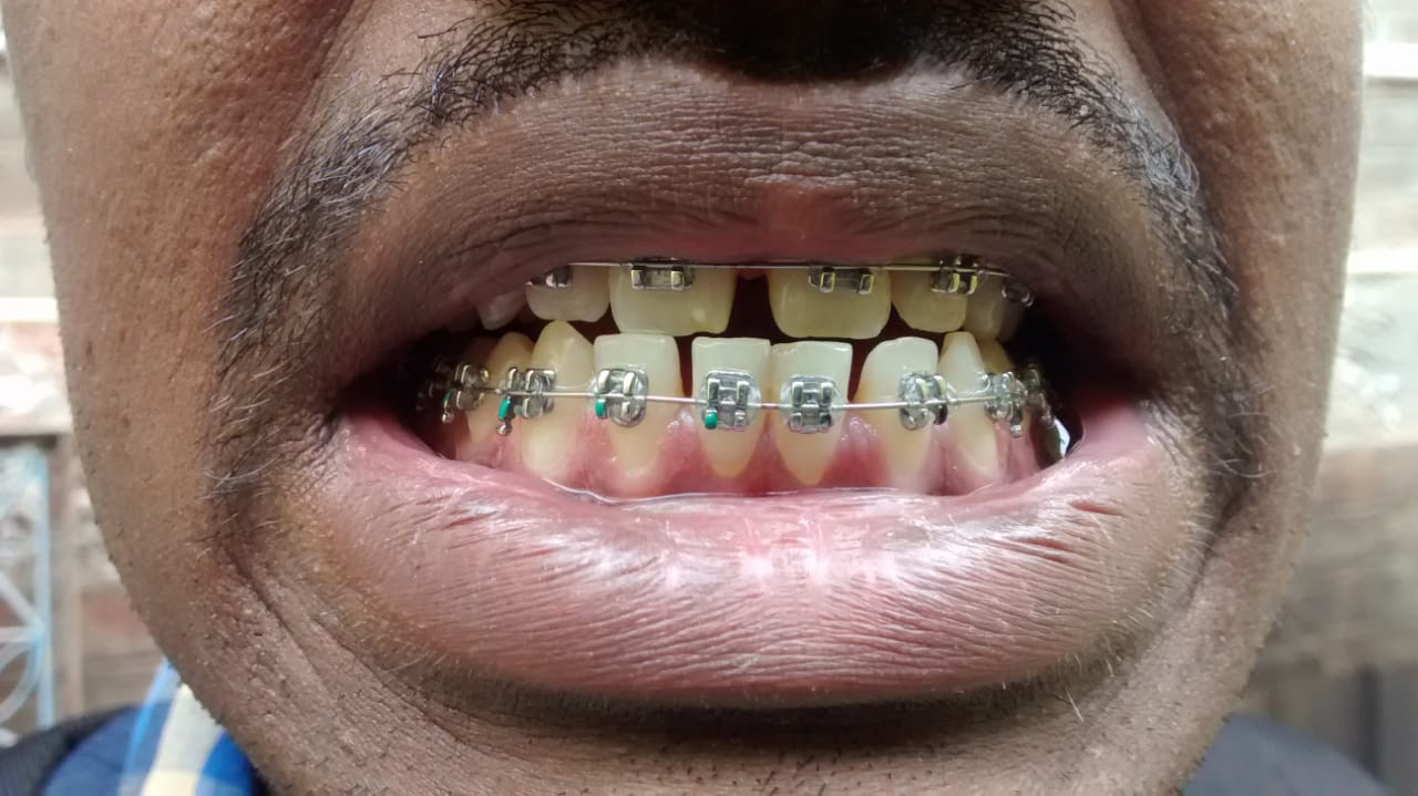 best dental hospial hosur